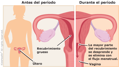 Cómo se diagnostica la dismenorrea: