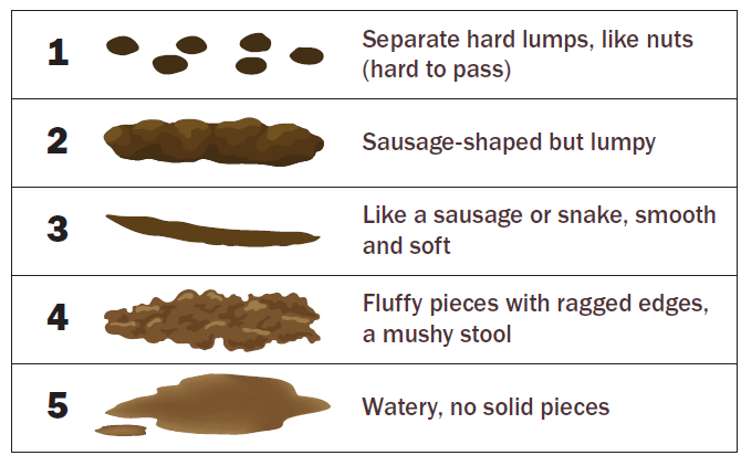 What is constipation?