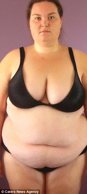 Why Breasts Sag After Weight Loss (and How to Prevent It)