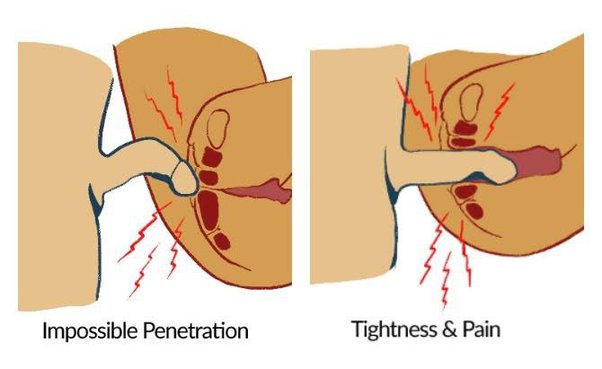 Things You Should Know Before You Have Sex for the First Time