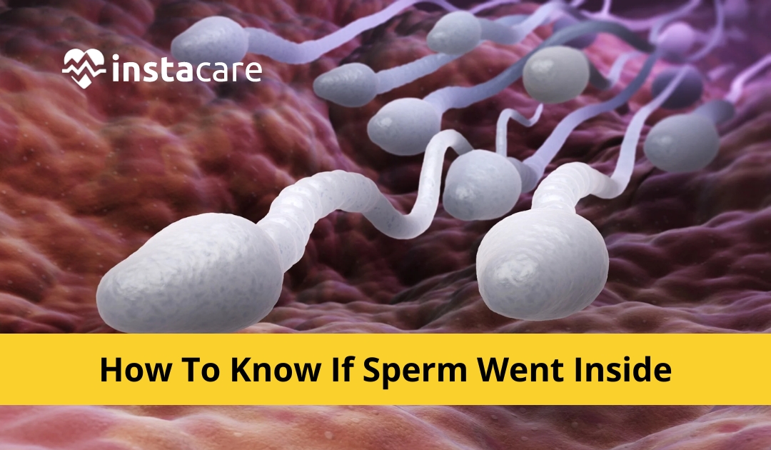 The Lifespan of a Sperm inside Vagina