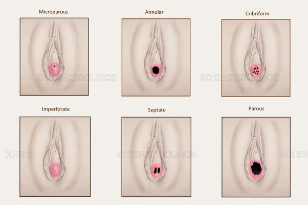 Understanding Virginity and The 5 Types of Virgins