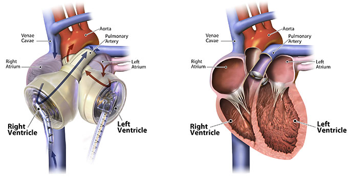 An artificial organ