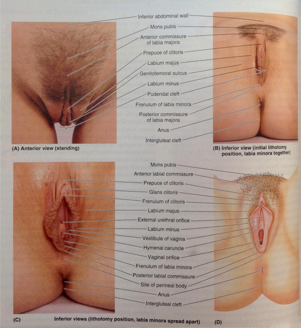 Labia augmentation using fat transfer