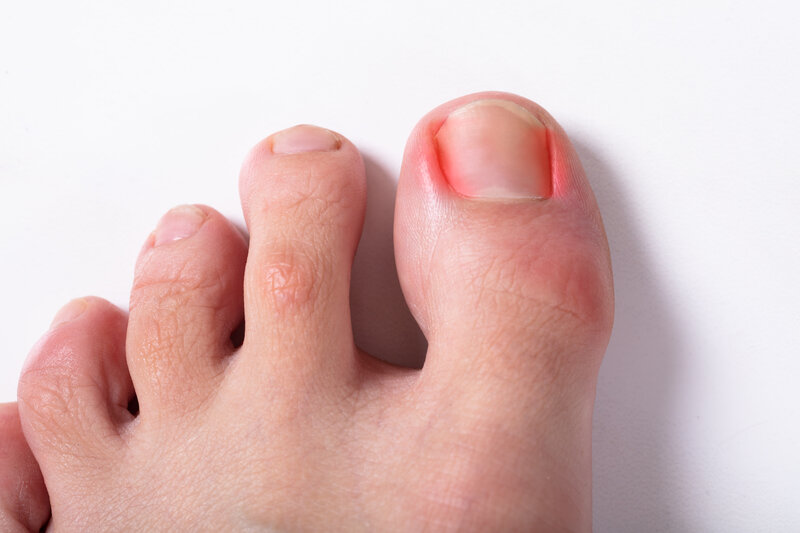 What causes big toe pain?