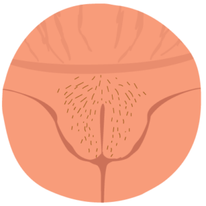 Types of vulvar cancer