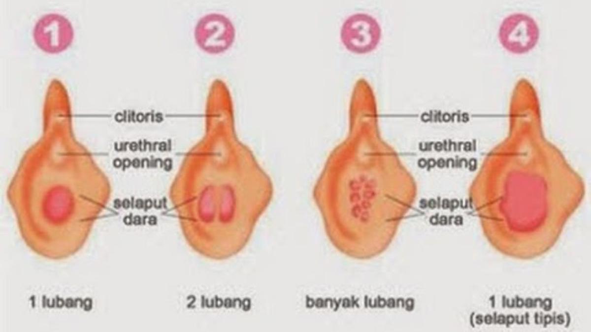 Vagina lubang kecil